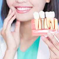 Dentist in white jacket holding one hand to her jaw while holding a model dental implant in the other